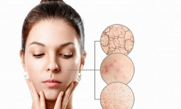 6 Penyebab Skin Barrier Rusak