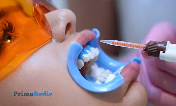 Ketahui Beberapa Bahaya Bleaching Gigi yang Paling Fatal