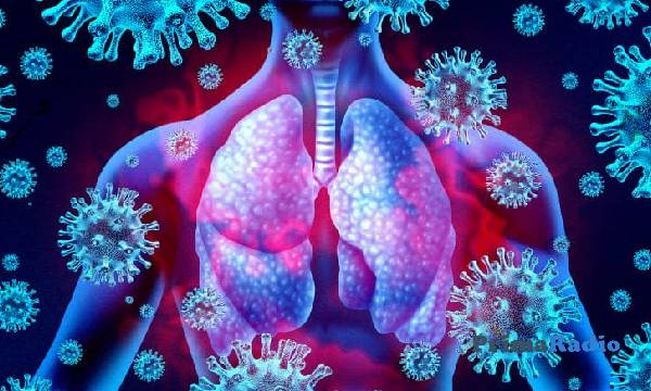 Apakah Itu Virus Pneumonia beserta Penyebab dan Gejalanya